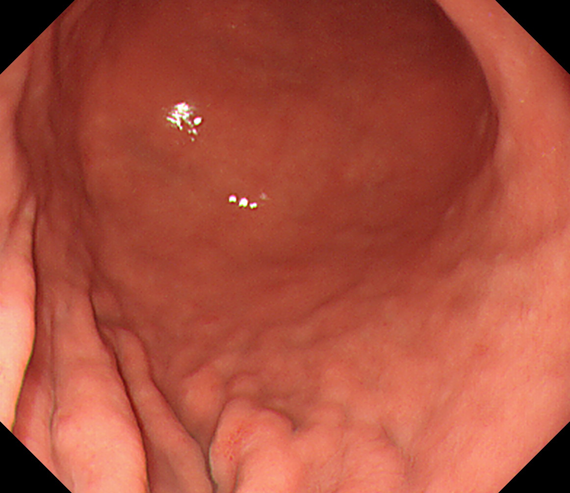 ���啔���^[�i���]]